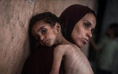 الأمم المتحدة: وفاة أكثر من 100 طفل في غزة بسبب سوء التغذية