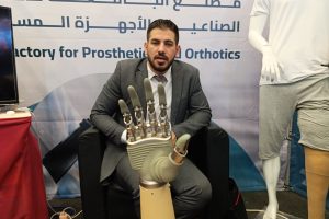أطراف صناعية “تنطق” في جنين
