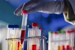 التحاليل الدموية بين الضرورة الطبية وهوس الفحوصات المتكررة